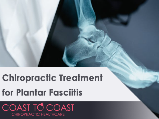 Chiropractic Treatment for Plantar Fasciitis